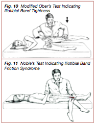 iliotibial band syndrome special tests