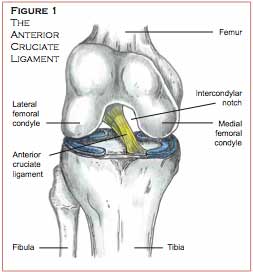 acl_1