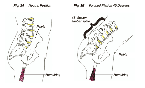 lowback1