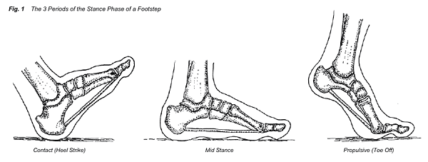 plantar1